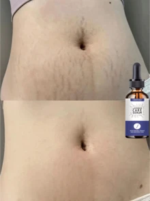 TRSTAY Milky Body Serum, Lightweight Fluid Texture For Dry Rough Body Skin, Glides Smoothly And Absorbs Without Greasy Buildup, Leaves Skin Feeling Soft Supple And Comfortable, Suitable For Shower Care, Daily Layering, Travel, And Seasonal Skincare - Multicolor - View 6