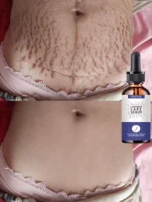 TRSTAY Milky Body Serum, Lightweight Fluid Texture For Dry Rough Body Skin, Glides Smoothly And Absorbs Without Greasy Buildup, Leaves Skin Feeling Soft Supple And Comfortable, Suitable For Shower Care, Daily Layering, Travel, And Seasonal Skincare - Multicolor - View 3