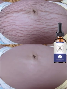 TRSTAY Milky Body Serum, Lightweight Fluid Texture For Dry Rough Body Skin, Glides Smoothly And Absorbs Without Greasy Buildup, Leaves Skin Feeling Soft Supple And Comfortable, Suitable For Shower Care, Daily Layering, Travel, And Seasonal Skincare - Multicolor - View 2