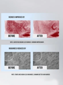 La Roche Posay B5 多效保濕修復面膜，1/5/10片，修復與強化肌膚屏障、減紅、改善粗糙，適合所有膚質 - 理膚泉B5面膜 - 查看 9