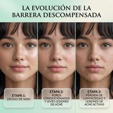 SADOER BHA And Niacinamide Facial Set 4-Step Tone-Unifying And Shine-Control System - Acne Whitening - View 3