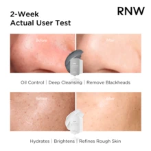 RNW DER. Professional Purifying Dual-Color Cleansing Mud Mask Set - Deep Cleaning - View 4