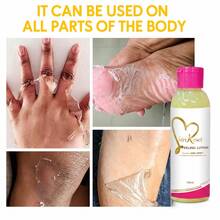Skin Reset Peeling Lotion, Exfoliating Face & Body Dead Skin Remover, Brightening & Even Skin Tone, Gentle Smoothing Skin Care, 100ml - Exfoliating Lotion - View 1