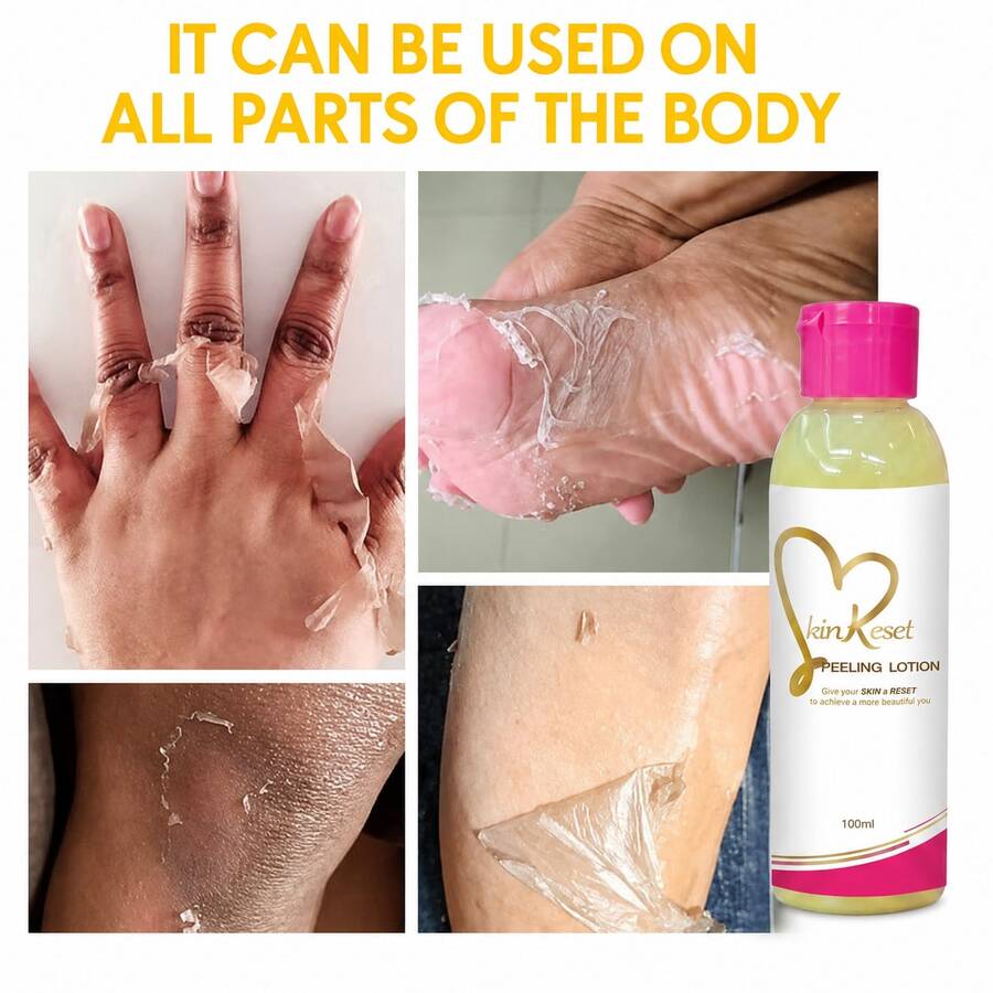 Skin Reset Peeling Lotion, Exfoliating Face & Body Dead Skin Remover, Brightening & Even Skin Tone, Gentle Smoothing Skin Care, 100ml - Exfoliating Lotion - View 1