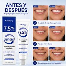 Teeth Whitening - Blue - View 5
