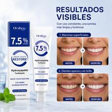 Teeth Whitening - Blue - View 7