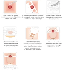Incontinence & Ostomy - Beige - View 6