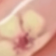 黃色