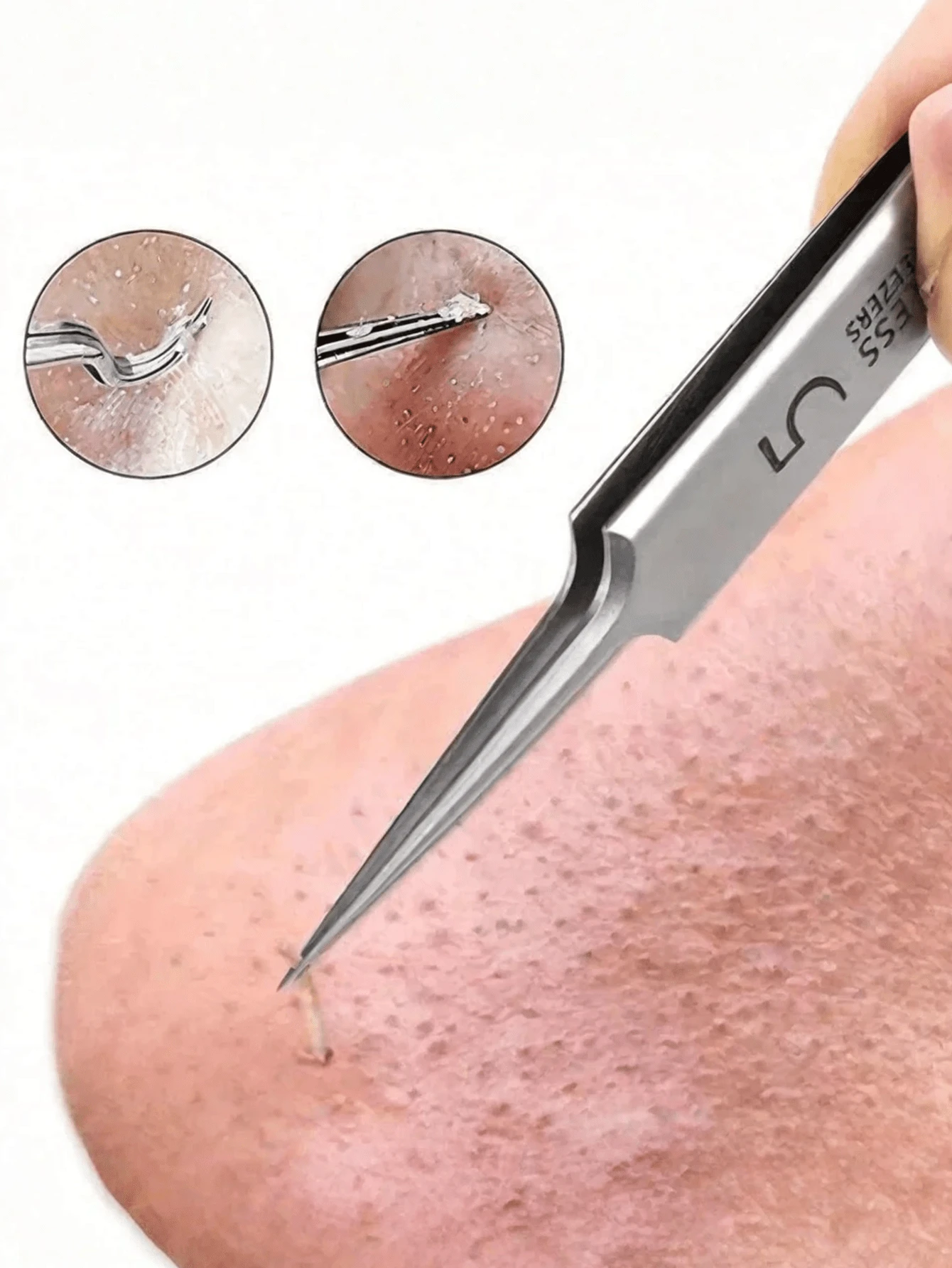 5mm Ultra-Fine Blackhead Tweezers - Facial Beauty Acne Removal Tool For Skin Care - Multicolor - View 1