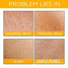 EELHOE Turmeric Exfoliating Scrub, Deep Cleansing Body And Face Scrub, Brightens Knees And Elbow Skin, Smooths Rough Skin, Use During Bathing - Turmeric - View 2
