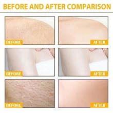 EELHOE Turmeric Exfoliating Scrub, Deep Cleansing Body And Face Scrub, Brightens Knees And Elbow Skin, Smooths Rough Skin, Use During Bathing - Turmeric - View 5