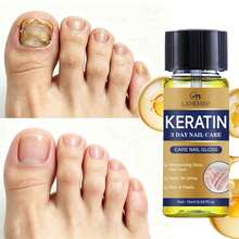 Keratin Nail Oil, Natural Plant Formula, Enhances Nail Surface Gloss, Repairs Weak And Damaged Nails, Suitable For Hands And Feet, 15ml - 15ml - View 1