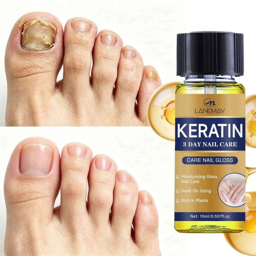 Keratin Nail Oil, Natural Plant Formula, Enhances Nail Surface Gloss, Repairs Weak And Damaged Nails, Suitable For Hands And Feet, 15ml - 15ml - View 1