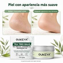 OUKEYA Bálsamo de Árbol de Té 80g con Lavanda y Menta, Hidratante para Piel Seca de Manos, Pies y Cuerpo - Bálsamo de árbol de té 80 g - Ver 6
