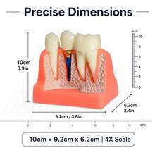 1pc/1 Sets 4X Scale Dental Implant Demonstration Model, Removable Crown Teeth Structure Display Model, Oral Anatomy Display Tool For Study & Presentation - Multicolor - View 5