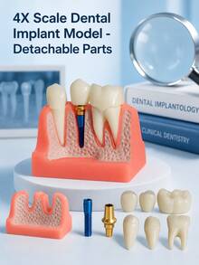 1pc/1 Sets 4X Scale Dental Implant Demonstration Model, Removable Crown Teeth Structure Display Model, Oral Anatomy Display Tool For Study & Presentation - Multicolor - View 6