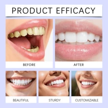 Feimuko 14 tiras blanqueadoras de dientes moradas, 30 min, corrector de color, blanqueamiento dental, aliento fresco, cuidado oral de larga duración, suave para dientes sensibles, eliminación de manchas, placa y dientes amarillos, para mujer y hombre - Fitas blanqueadoras para dientes morados - Ver 8