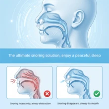 3pcs / 7PCS Anti-Snoring Nasal Dilators, Silicone Invisible Nose Expander, Nasal Congestion Relief Device, Washable And Reusable - Black - View 3
