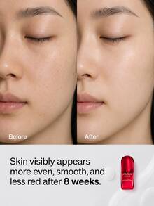 Shiseido Ultimune Power Infusing Serum 15ml+ Clarifying Cleansing Foam 50ml - Hyaluronic Acid - View 4