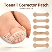 10/30/50/100pcs Embedded Ingrown Nail Repair Patches, Breathable Ingrown Nail Stickers, Easy Application, No Glue Needed, Foot And Hand Care - Multi-color - View 1