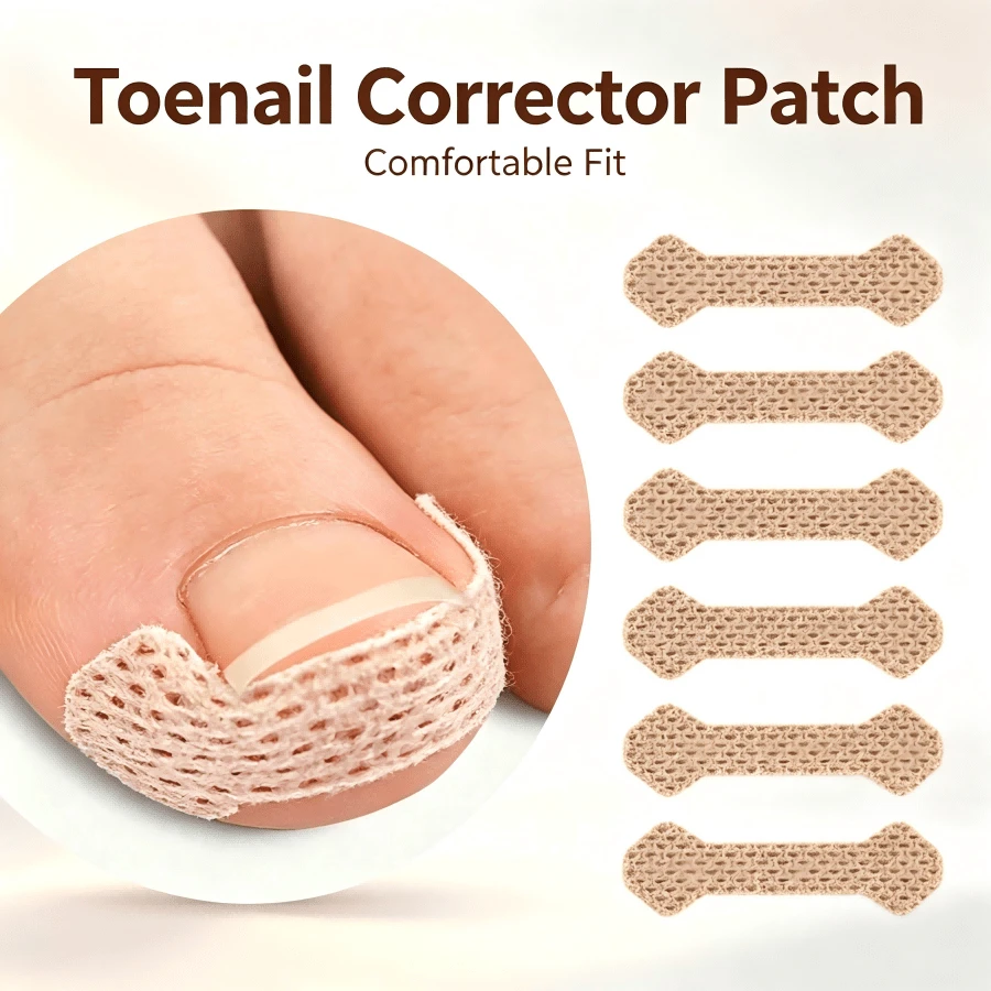 10/30/50/100pcs Embedded Ingrown Nail Repair Patches, Breathable Ingrown Nail Stickers, Easy Application, No Glue Needed, Foot And Hand Care - Multi-color - View 1
