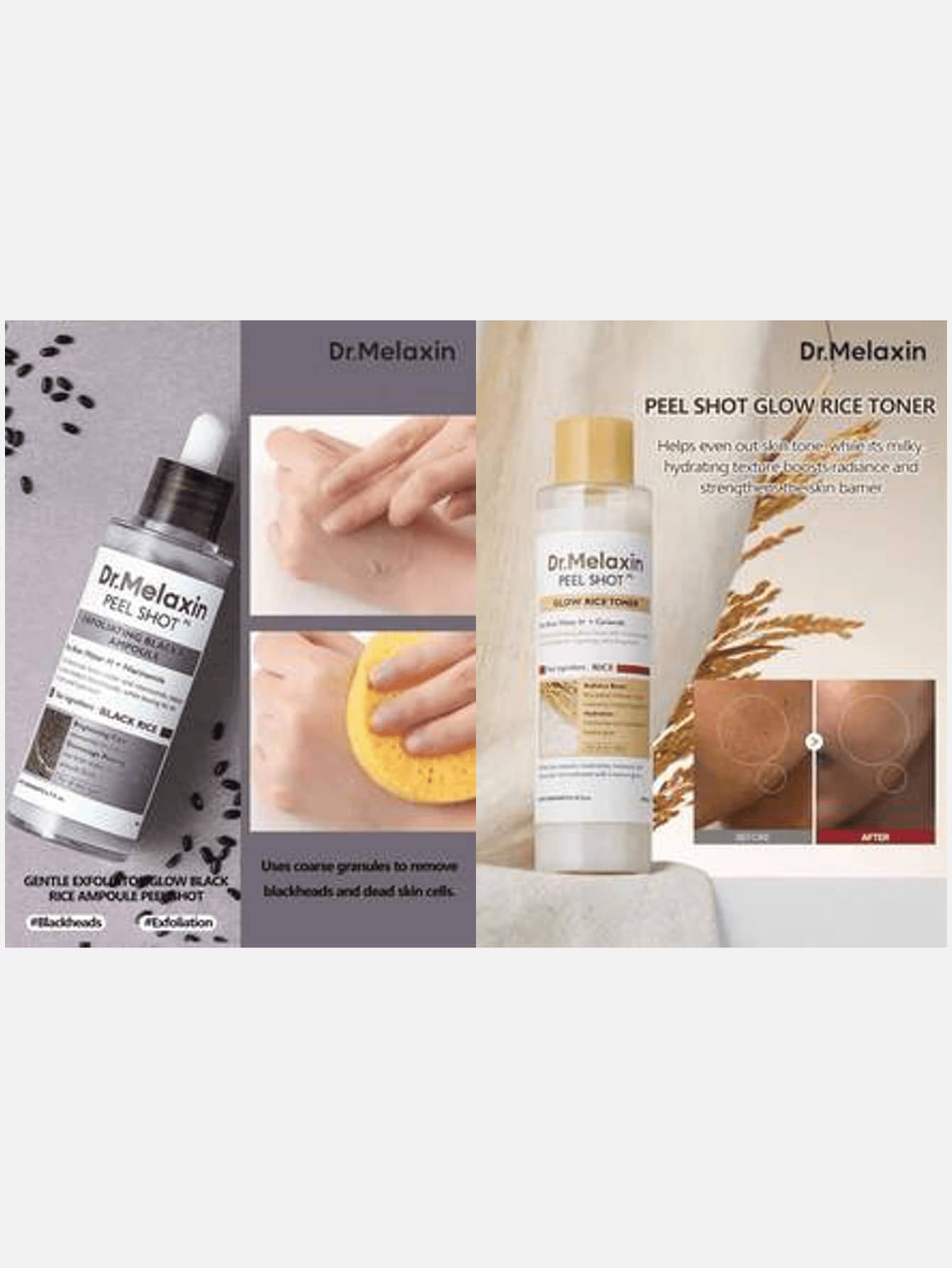 2件組韓系保養套組:Dr.Melaxin 米亮白化妝水 200ml & 去角質磨砂凝膠 80ml,打造光滑發亮肌膚 - 亮膚細緻毛孔雙效合一 - 查看 1