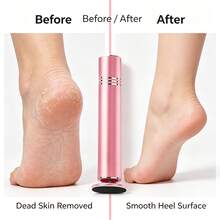1pc Portable Electric Callus Remover, Handheld Foot File With Replacement Sand Discs, Pedicure Tool For Removing Dead Skin & Cracked Heels - Multicolor - View 8