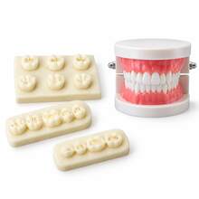 Dental Caries Model, Can Be Used As Collectible Decor, Store Entrance Display Model, Practice Model, Caries Exhibition Display Model, Caries Introduction Tool - Multicolor - View 13