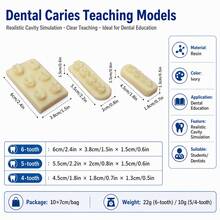 Dental Caries Model, Can Be Used As Collectible Decor, Store Entrance Display Model, Practice Model, Caries Exhibition Display Model, Caries Introduction Tool - Multicolor - View 2