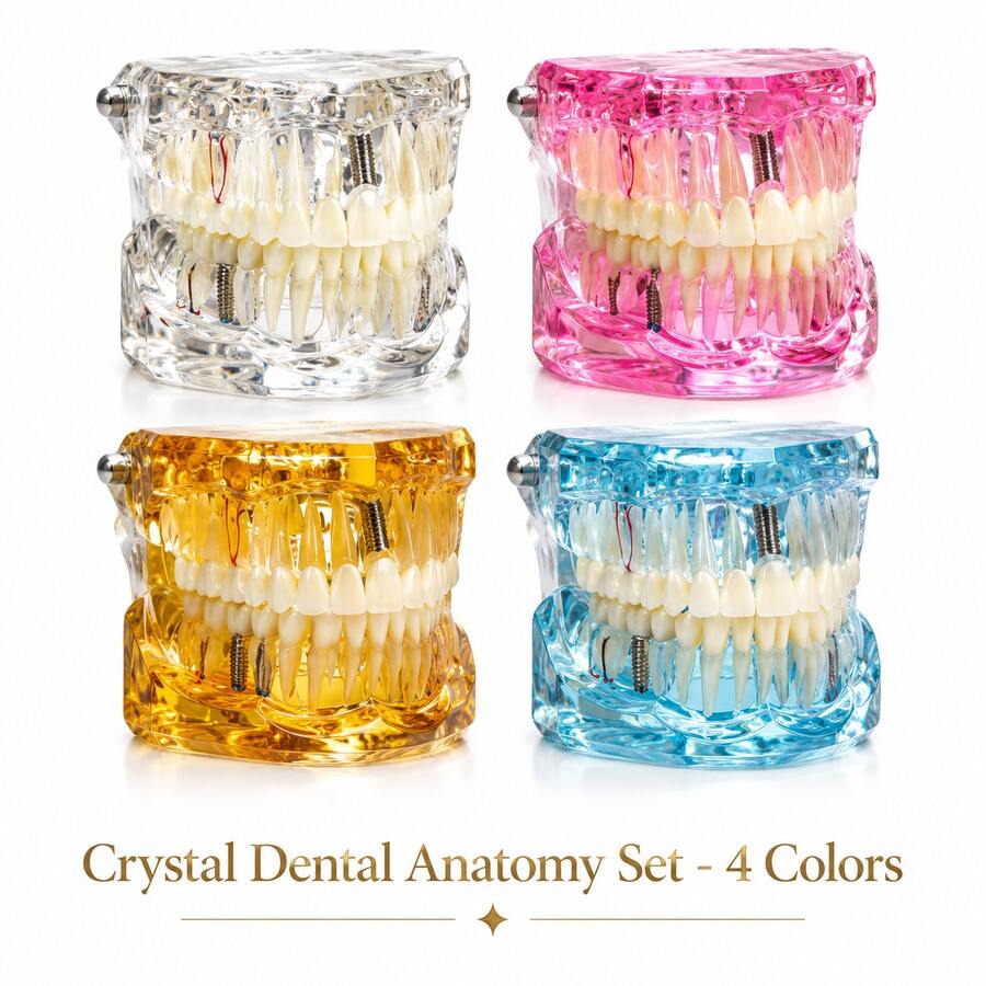 Large Pathology Dental Model, Transparent, Blue, Orange, Pink Optional, Clear Internal Structure, Detachable Oral Model, Large Bridge Explanation Model For Tooth Care, Suitable For Collection, Display Stand Decor, Home Interactive Collection - Multicolor - View 1