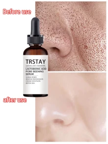 Serum Pelembap Wajah 5ML/15ML/30ML/50ML/100ML, Tekstur Lembut dan Ringan, Mengembalikan Kelembapan Kulit, Membuat Kulit Halus dan Segar, Menjaga Kondisi Kulit Tetap Terhidrasi dan Lembut - MultiWarna - View 5