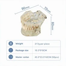 Large Pathology Dental Model, Transparent, Blue, Orange, Pink Optional, Clear Internal Structure, Detachable Oral Model, Large Bridge Explanation Model For Tooth Care, Suitable For Collection, Display Stand Decor, Home Interactive Collection - Multicolor - View 2